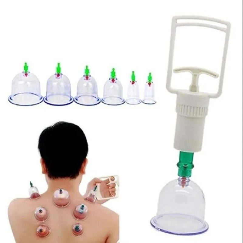 KIT VENTOSATERAPIA 12 VENTOSAS COPOS MASSOTERAPIA CHINES ACUMPUTURA TERAPIA SUCC